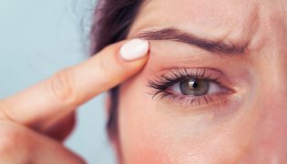 Mioquimia Facial: O Mistério Por Trás dos Tremores nas Pálpebras