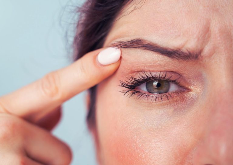 Mioquimia Facial: O Mistério Por Trás dos Tremores nas Pálpebras